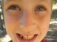 IMG 20150727 171219  Noah lost a tooth